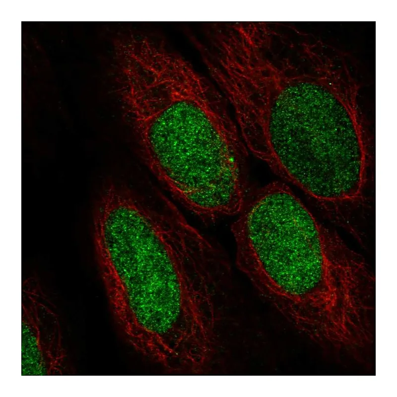 Atlas Antibodies Anti-ASF1A Antibody