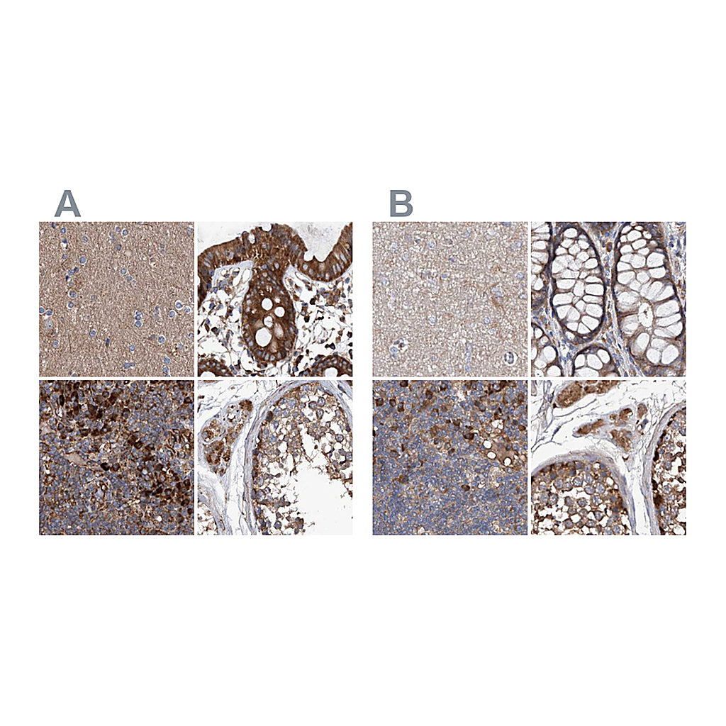 Atlas Antibodies Anti-ASCC3 Antibody