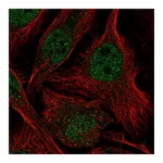Atlas Antibodies Anti-ASF1B Antibody