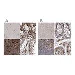 Atlas Antibodies Anti-ASCC3 Antibody