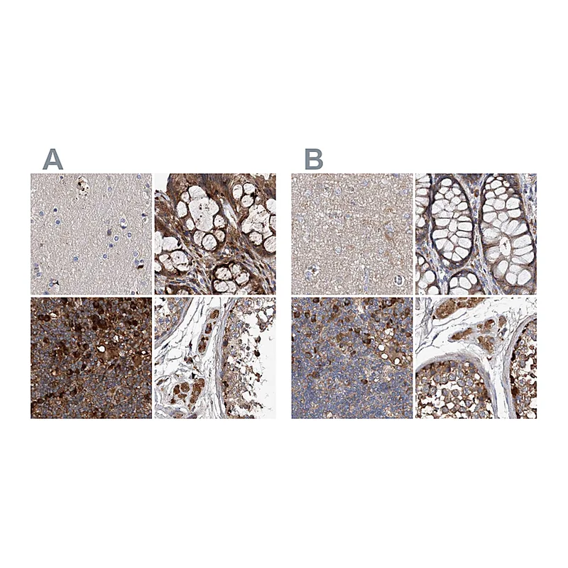 Atlas Antibodies Anti-ASCC3 Antibody