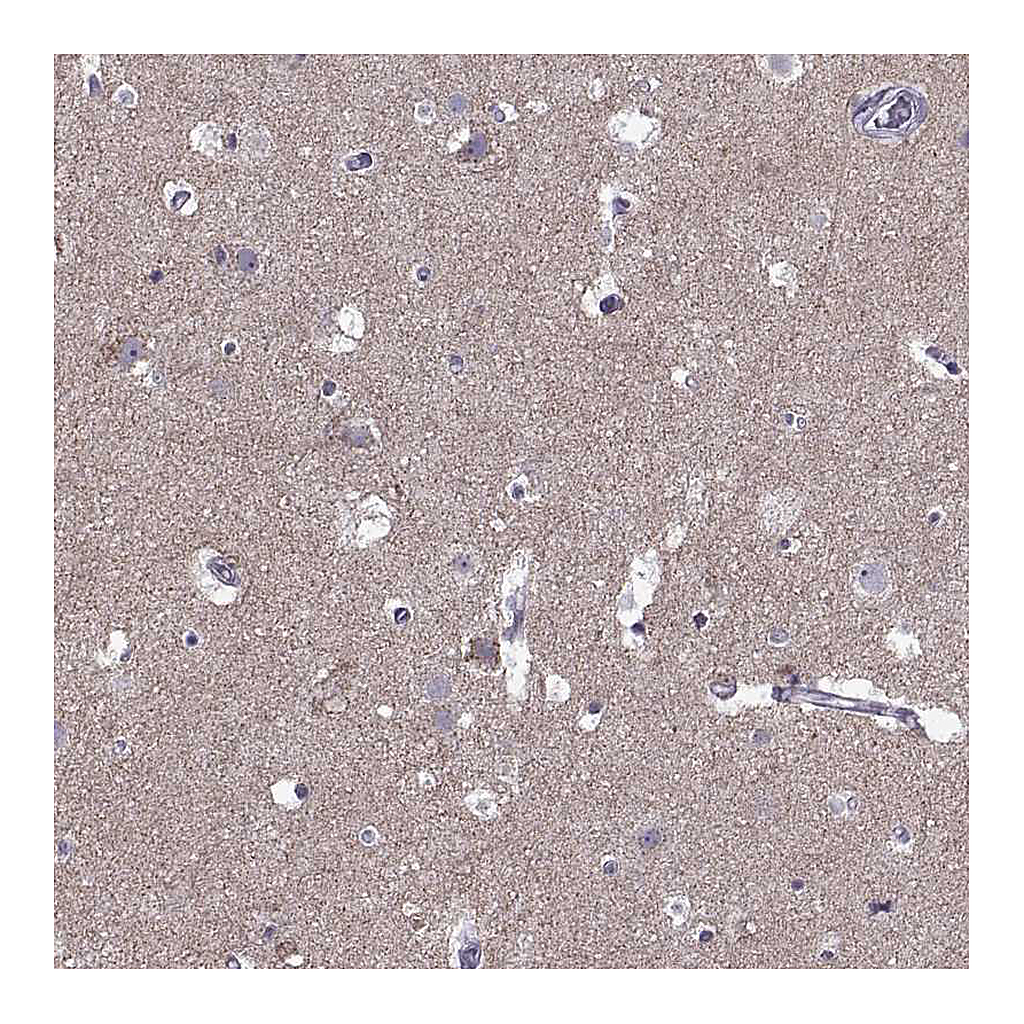 Atlas Antibodies Anti-ASIC2 Antibody