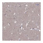 Atlas Antibodies Anti-ASIC2 Antibody