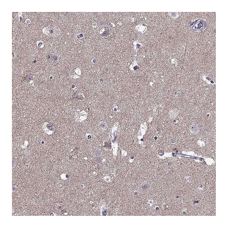 Atlas Antibodies Anti-ASIC2 Antibody