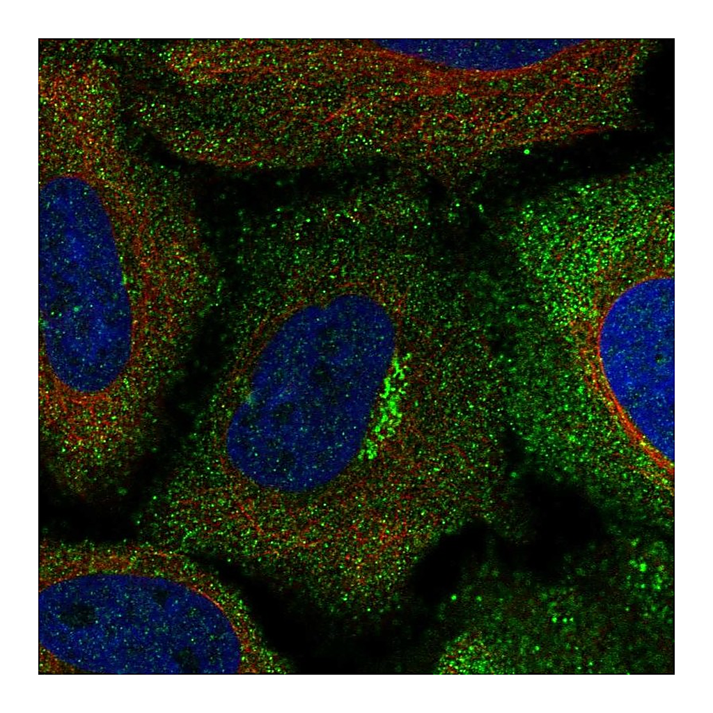 Atlas Antibodies Anti-ASIC1 Antibody