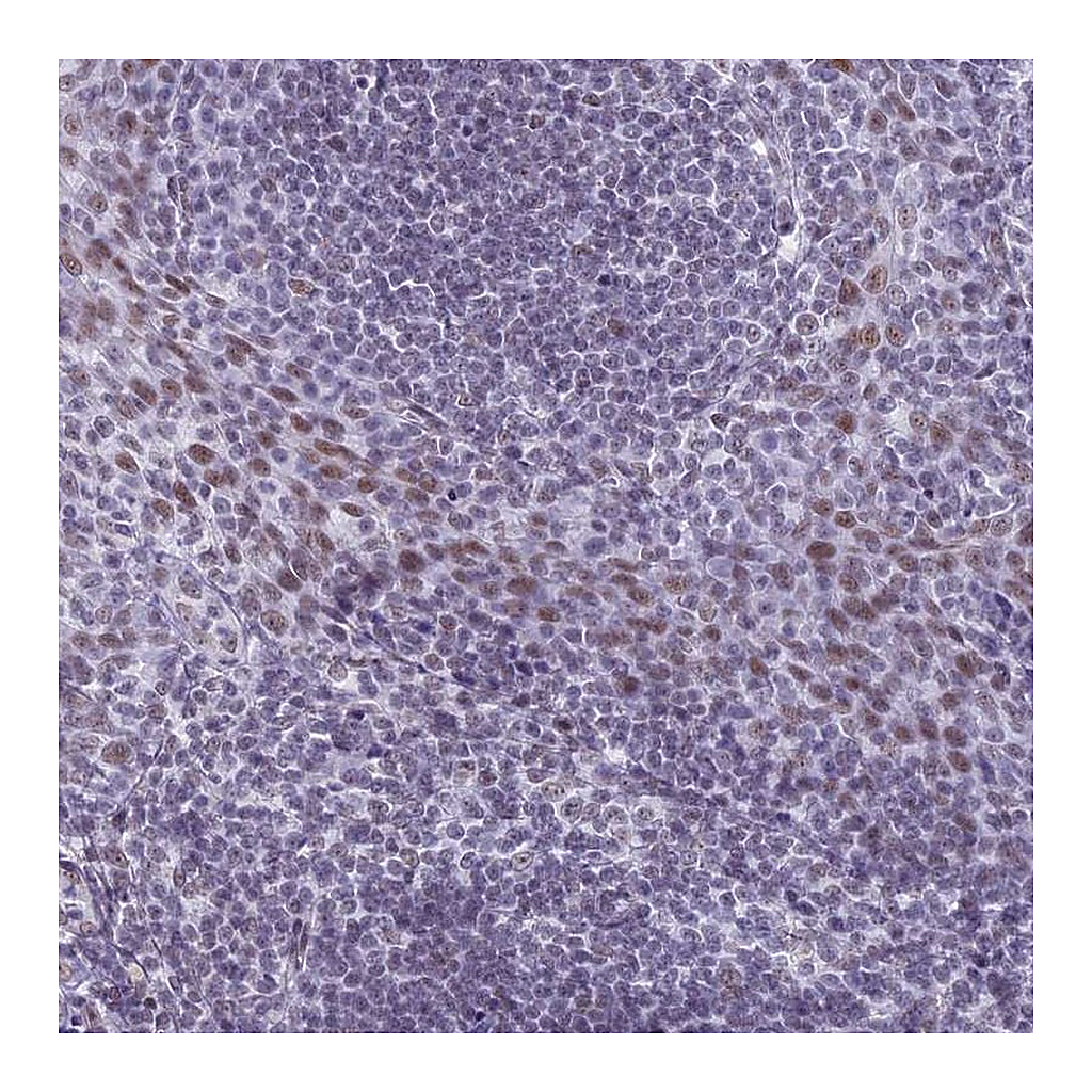 Atlas Antibodies Anti-ASH2L Antibody