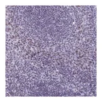 Atlas Antibodies Anti-ASH2L Antibody