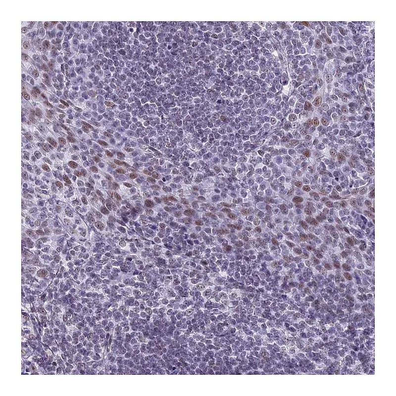 Atlas Antibodies Anti-ASH2L Antibody