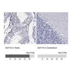 Atlas Antibodies Anti-ASF1B Antibody