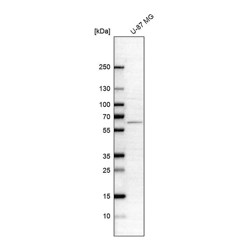 Atlas Antibodies Anti-ASNS Antibody