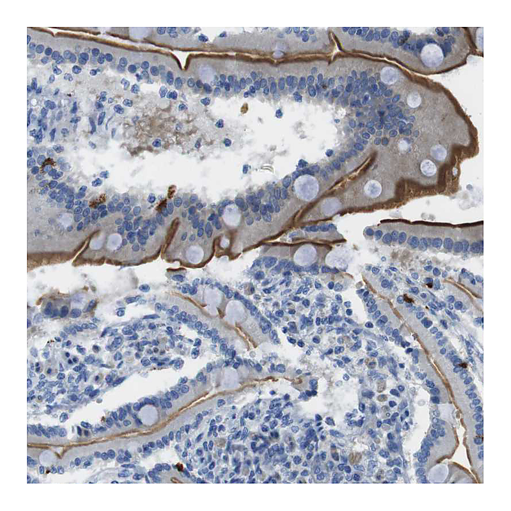 Atlas Antibodies Anti-ASIC5 Antibody