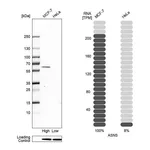 Atlas Antibodies Anti-ASNS Antibody