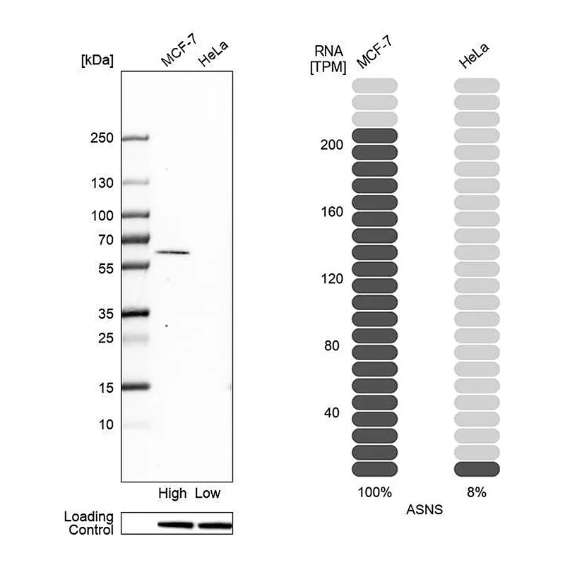 Atlas Antibodies Anti-ASNS Antibody