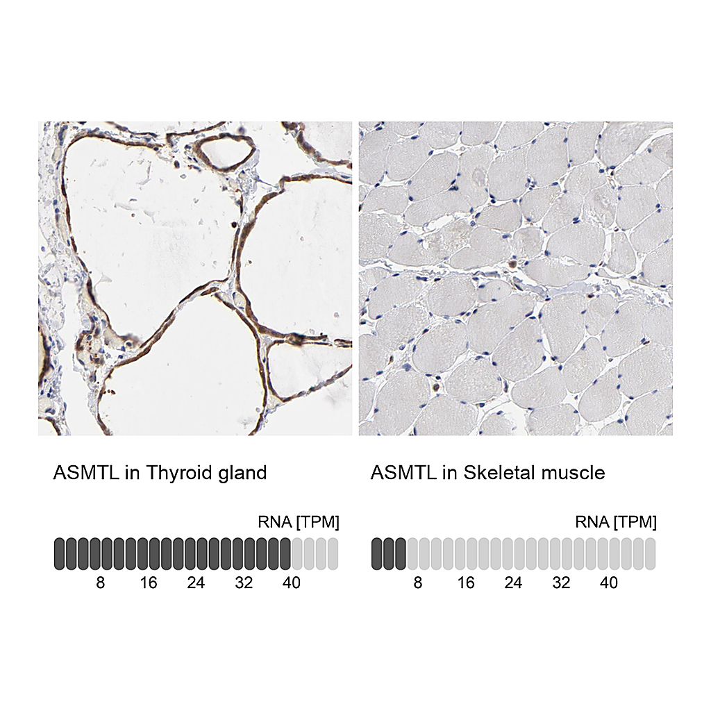 Atlas Antibodies Anti-ASMTL Antibody