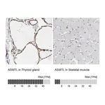 Atlas Antibodies Anti-ASMTL Antibody