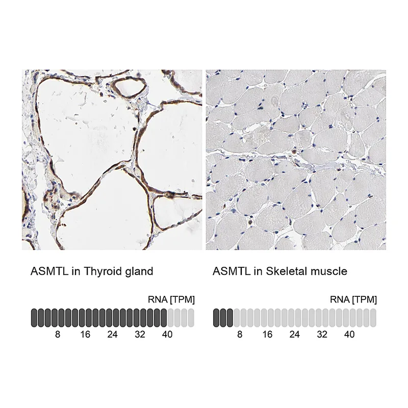 Atlas Antibodies Anti-ASMTL Antibody