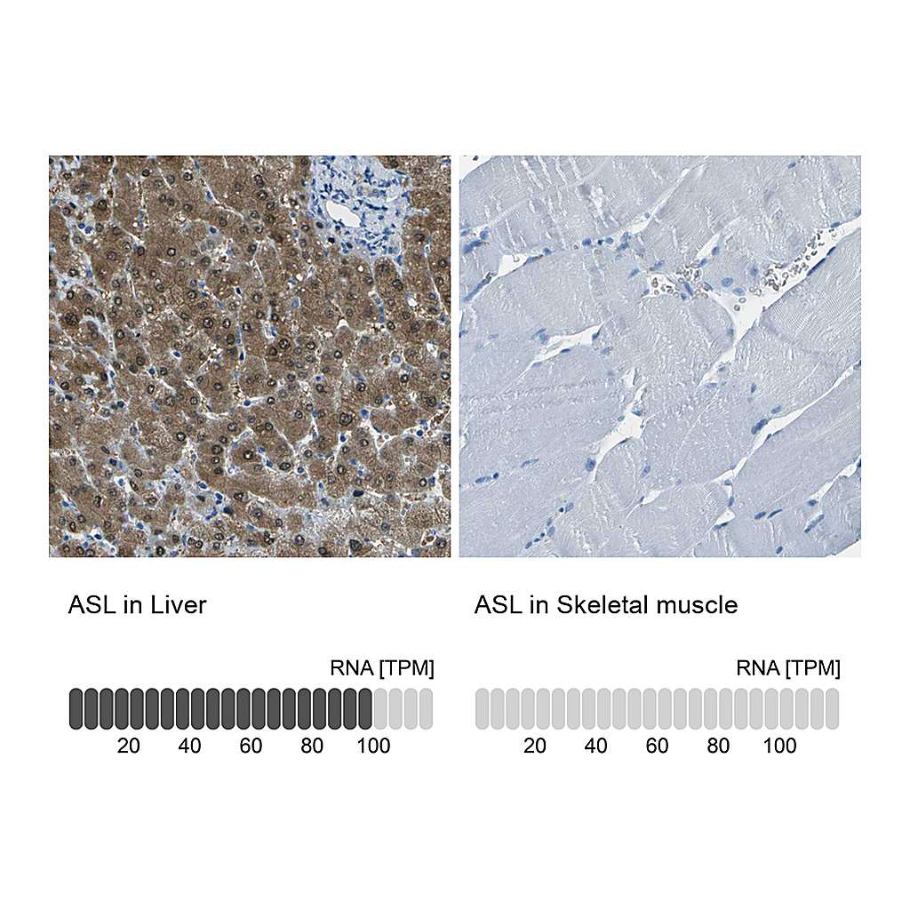 Atlas Antibodies Anti-ASL Antibody