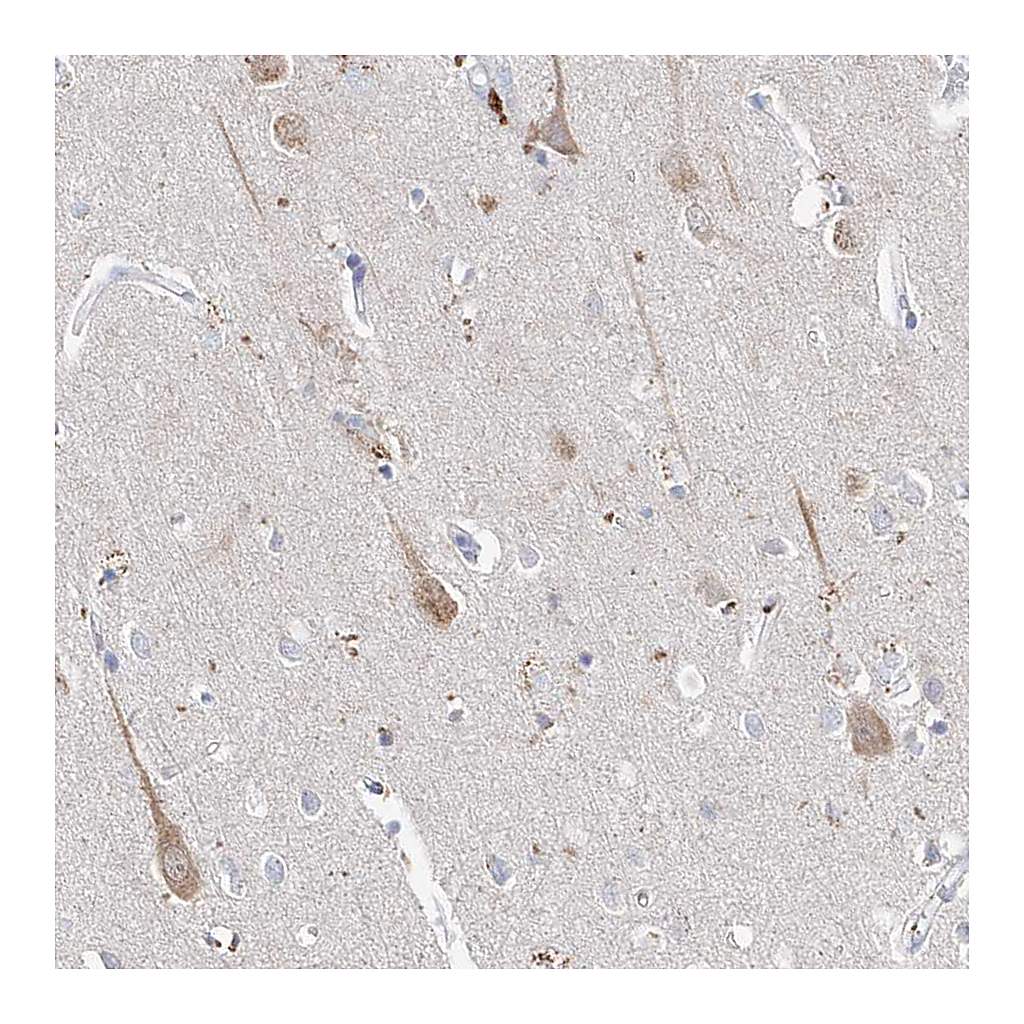 Atlas Antibodies Anti-ASNS Antibody