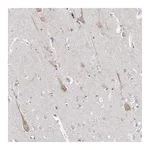 Atlas Antibodies Anti-ASNS Antibody