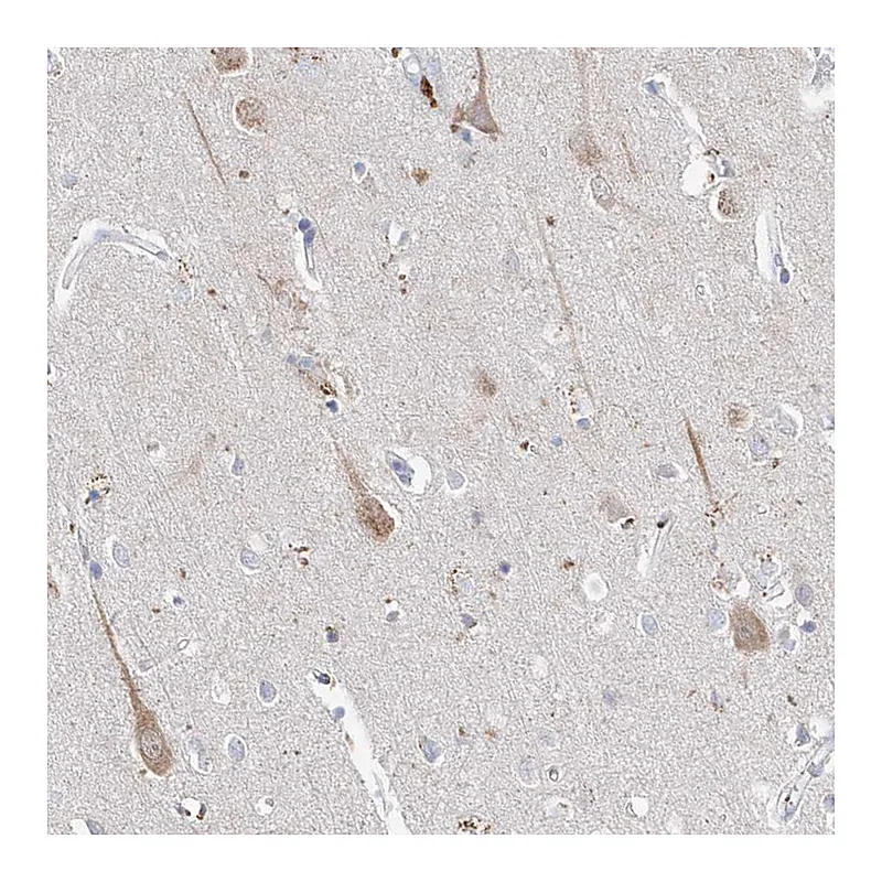 Atlas Antibodies Anti-ASNS Antibody