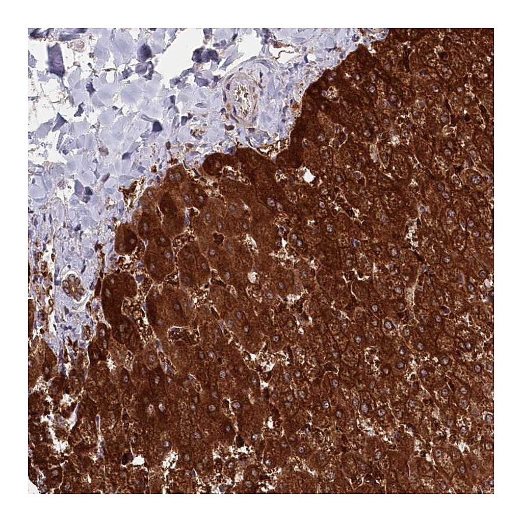 Atlas Antibodies Anti-ASNSD1 Antibody
