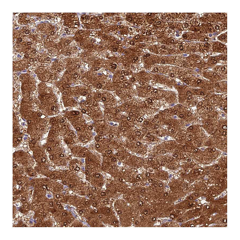 Atlas Antibodies Anti-ASPDH Antibody