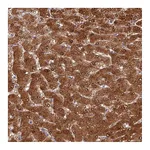 Atlas Antibodies Anti-ASPDH Antibody