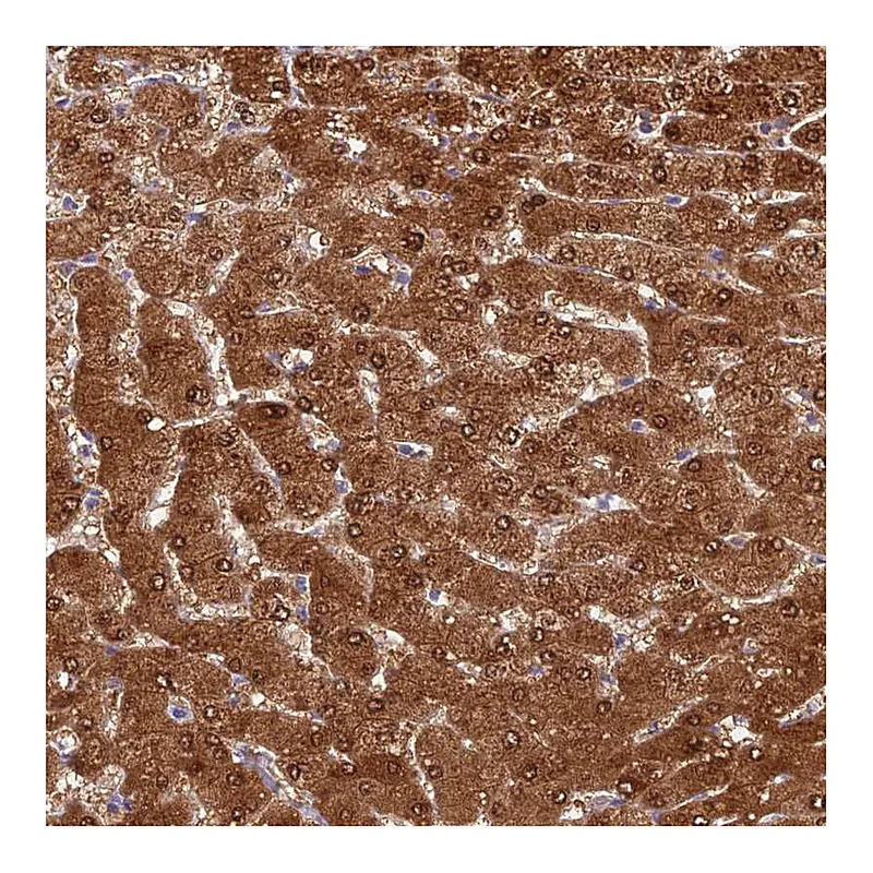 Atlas Antibodies Anti-ASPDH Antibody