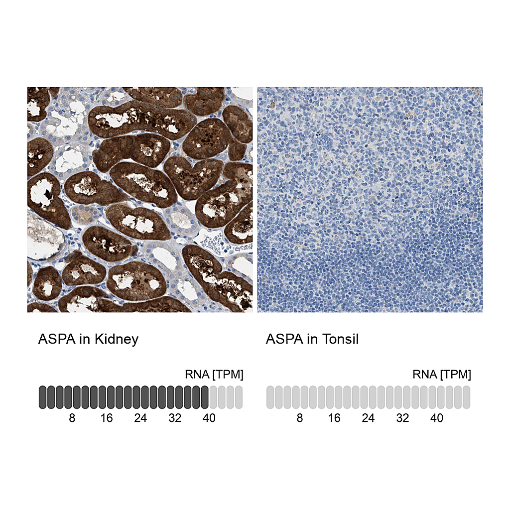 Atlas Antibodies Anti-ASPA Antibody
