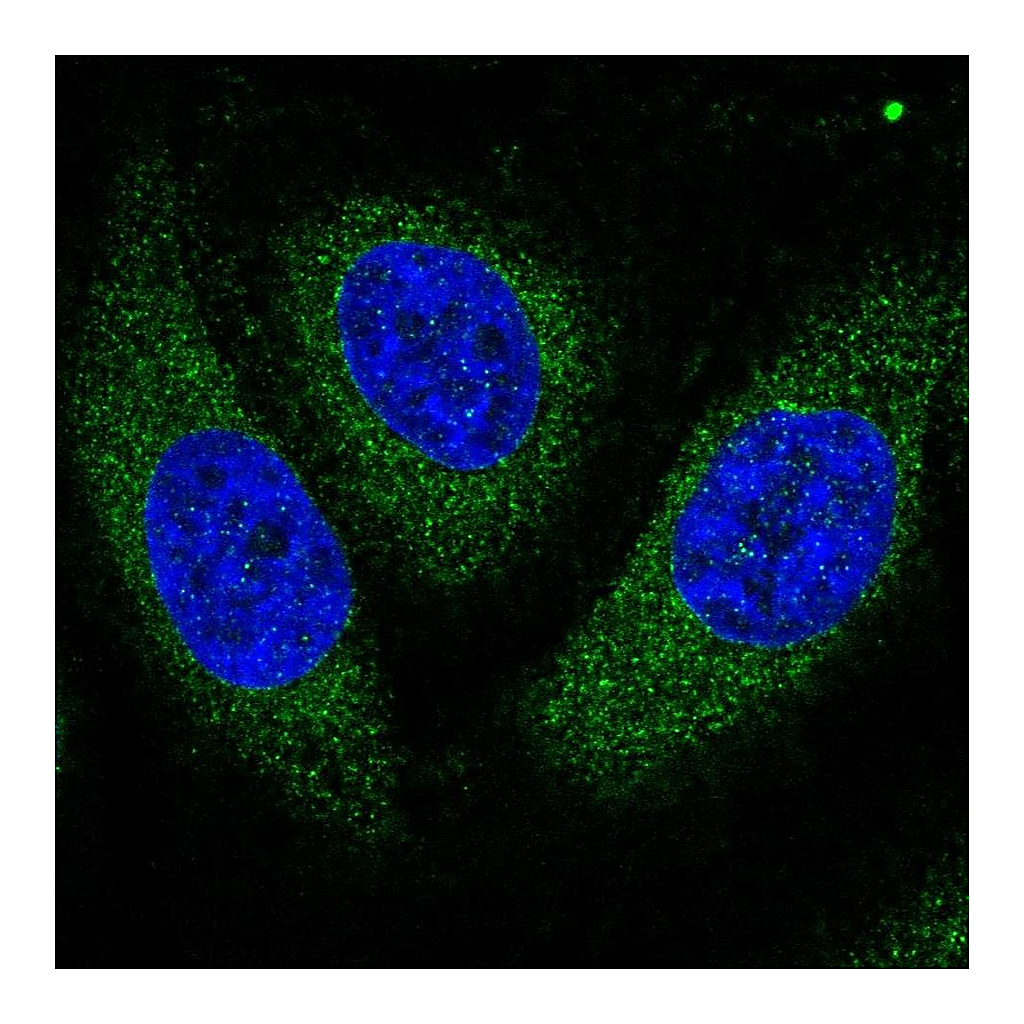 Atlas Antibodies Anti-ASPH Antibody