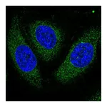 Atlas Antibodies Anti-ASPH Antibody