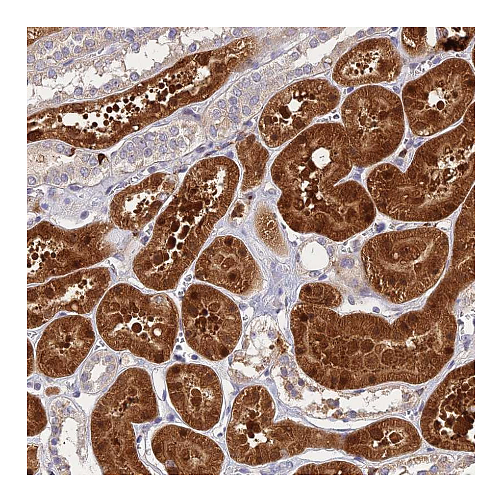 Atlas Antibodies Anti-ASPDH Antibody