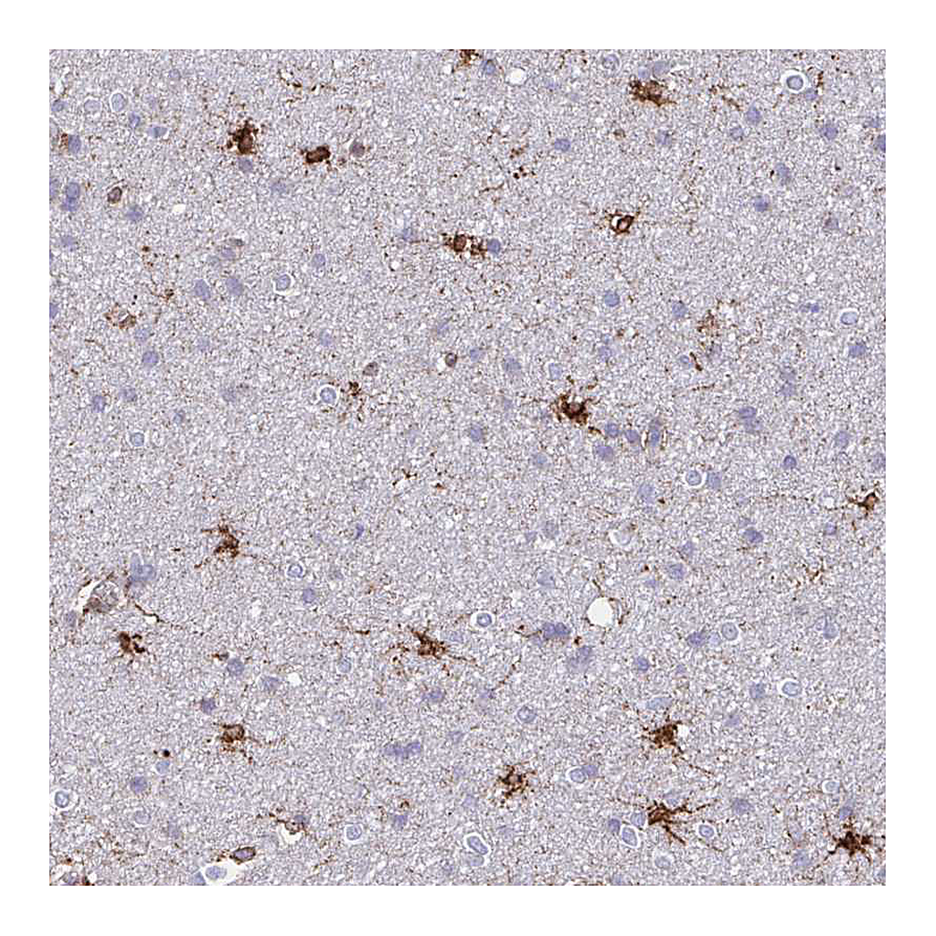 Atlas Antibodies Anti-ASPH Antibody