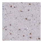 Atlas Antibodies Anti-ASPH Antibody