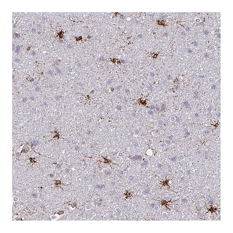 Atlas Antibodies Anti-ASPH Antibody