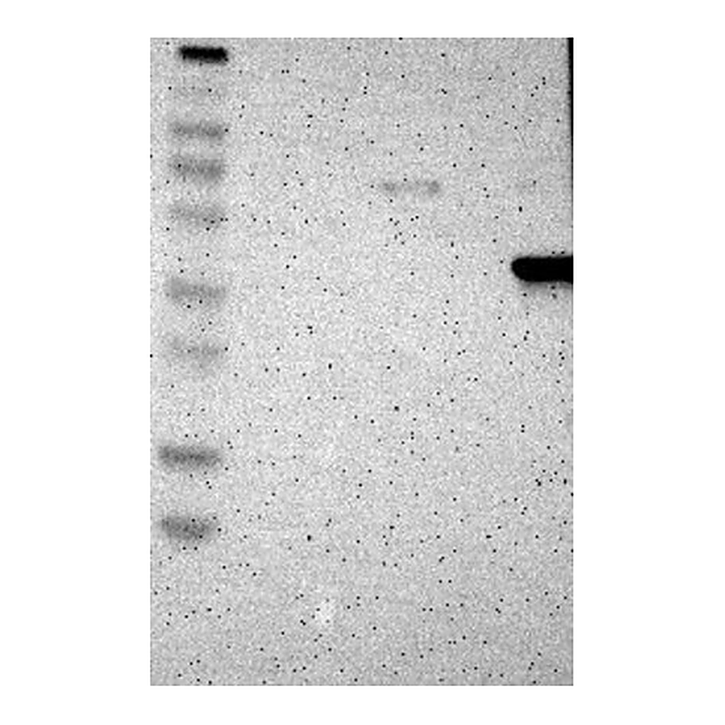 Atlas Antibodies Anti-ASPN Antibody