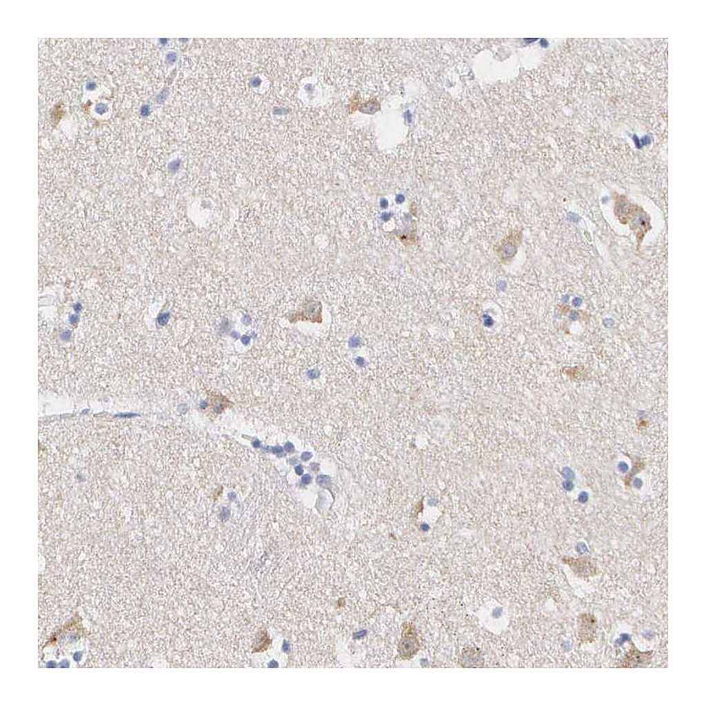 Atlas Antibodies Anti-ASPHD2 Antibody