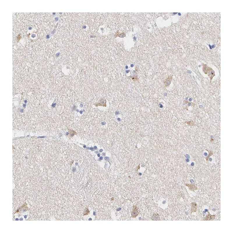Atlas Antibodies Anti-ASPHD2 Antibody