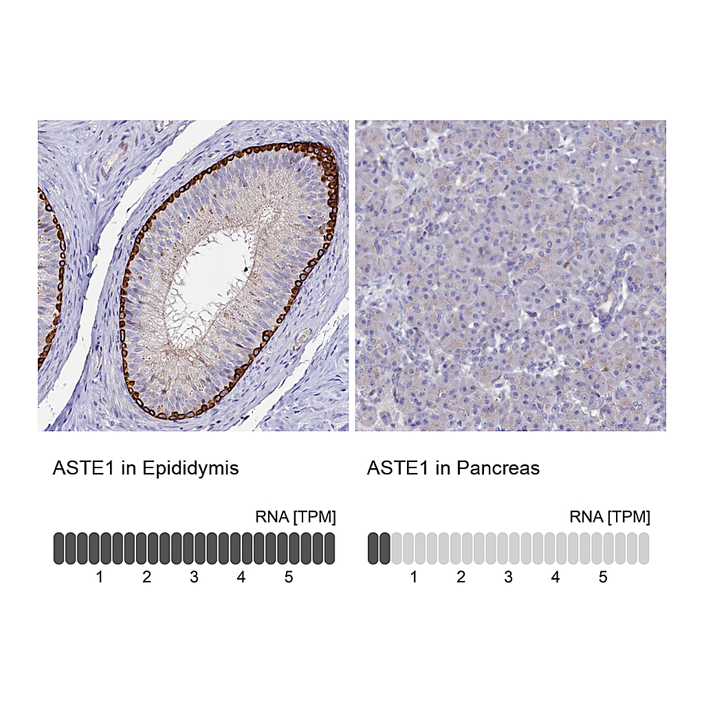 Atlas Antibodies Anti-ASTE1 Antibody