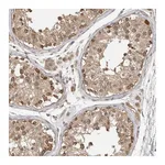 Atlas Antibodies Anti-ASPSCR1 Antibody