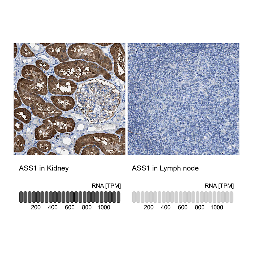 Atlas Antibodies Anti-ASS1 Antibody