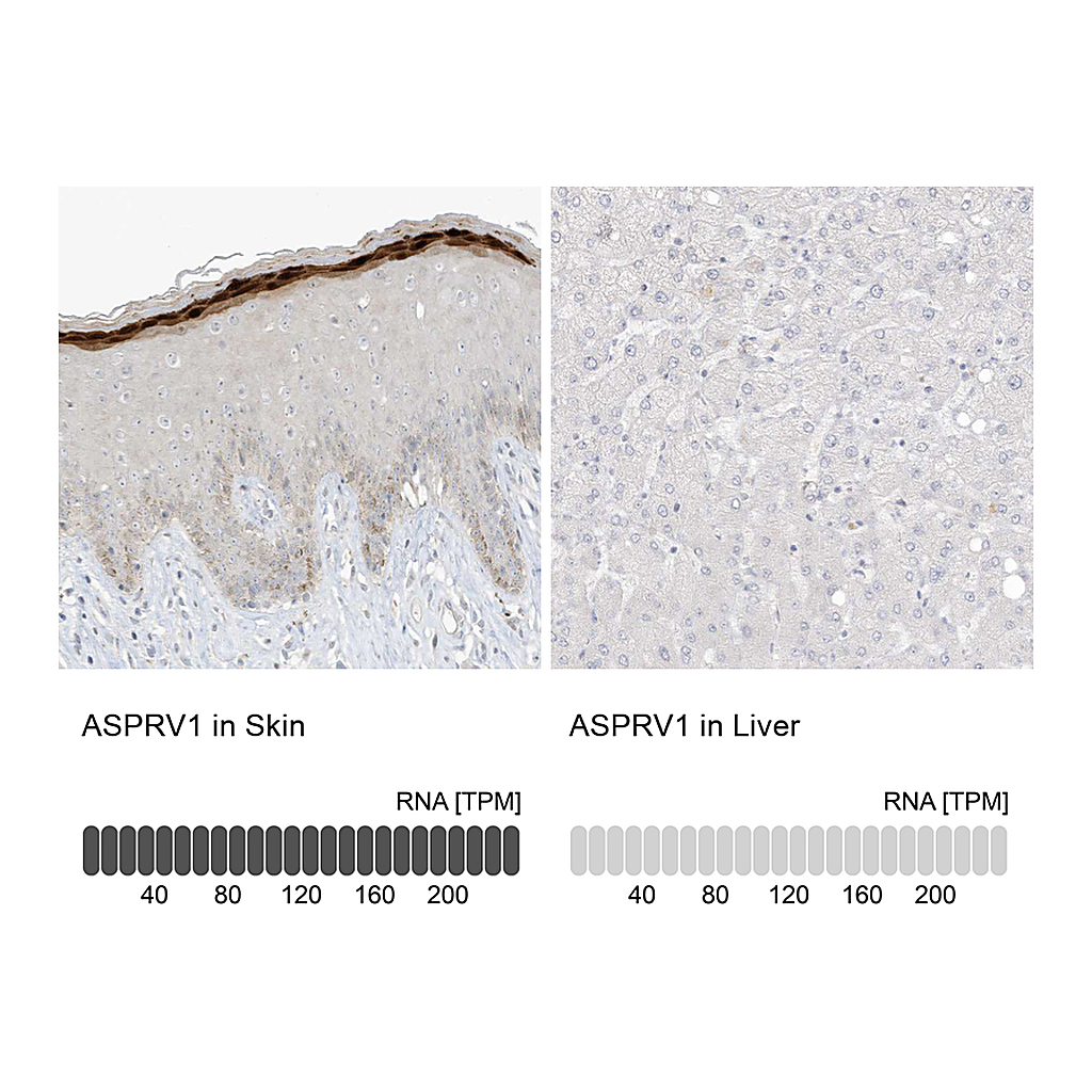 Atlas Antibodies Anti-ASPRV1 Antibody