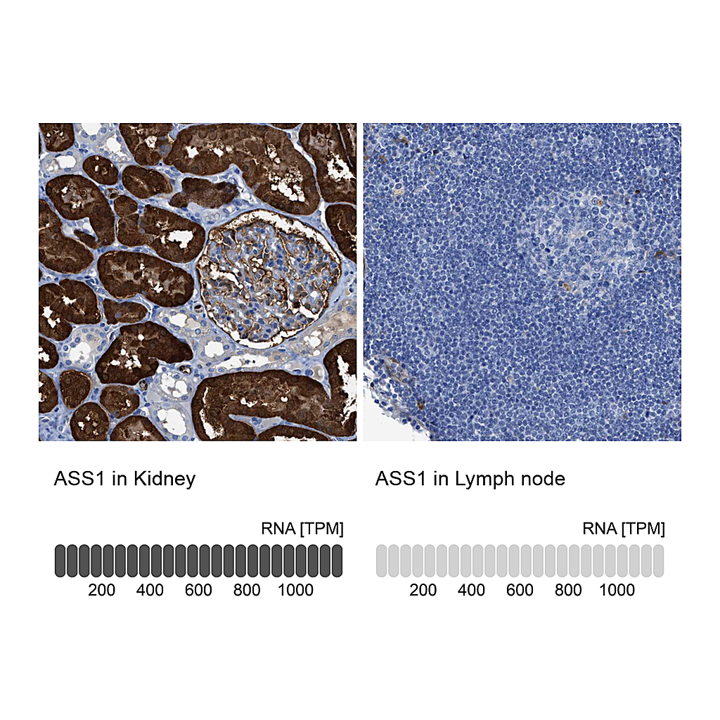 Atlas Antibodies Anti-ASS1 Antibody