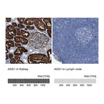 Atlas Antibodies Anti-ASS1 Antibody