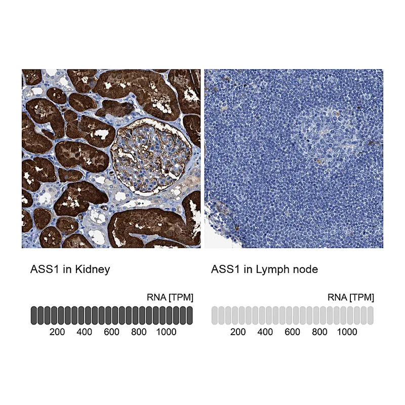 Atlas Antibodies Anti-ASS1 Antibody