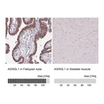 Atlas Antibodies Anti-ASRGL1 Antibody