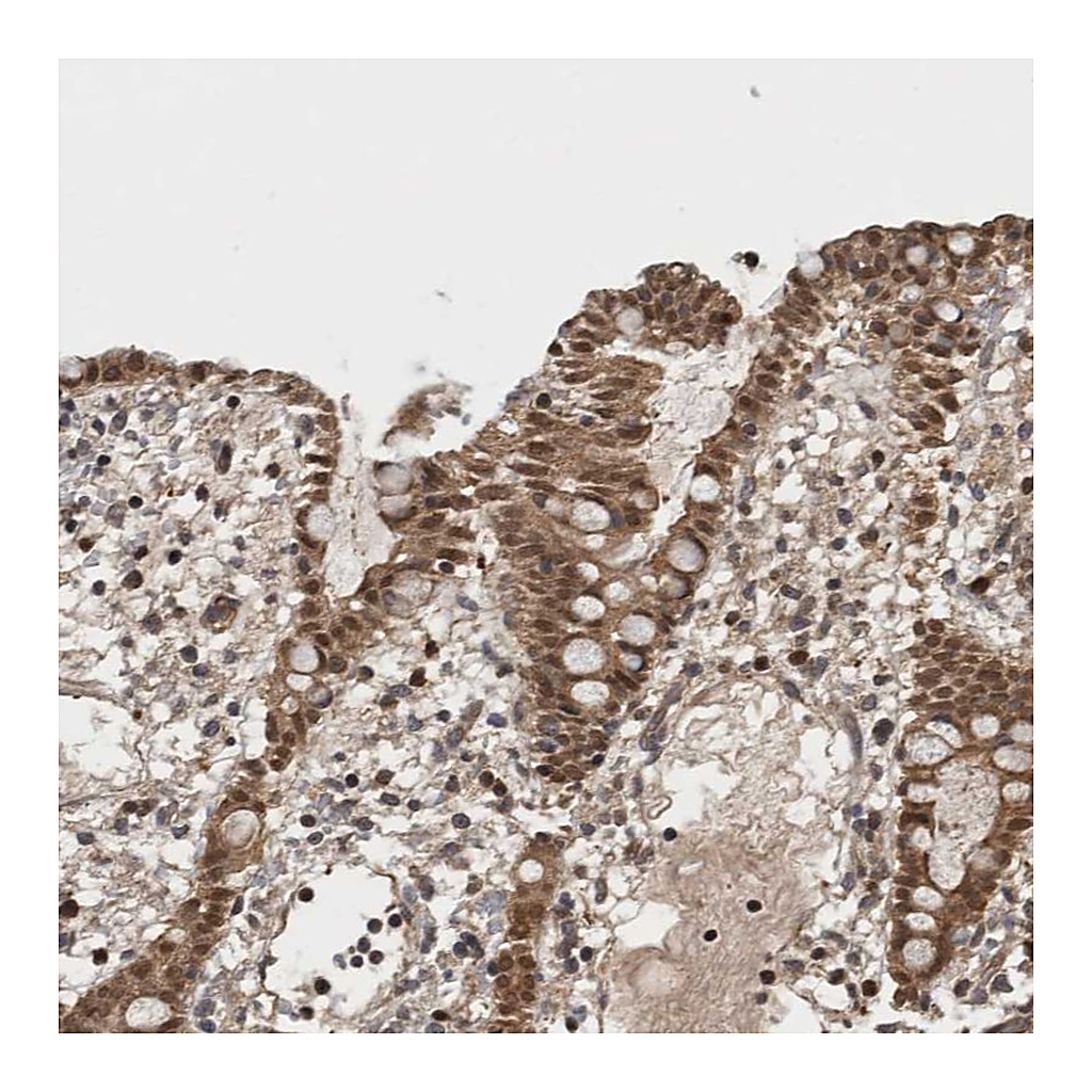 Atlas Antibodies Anti-ASTN2 Antibody
