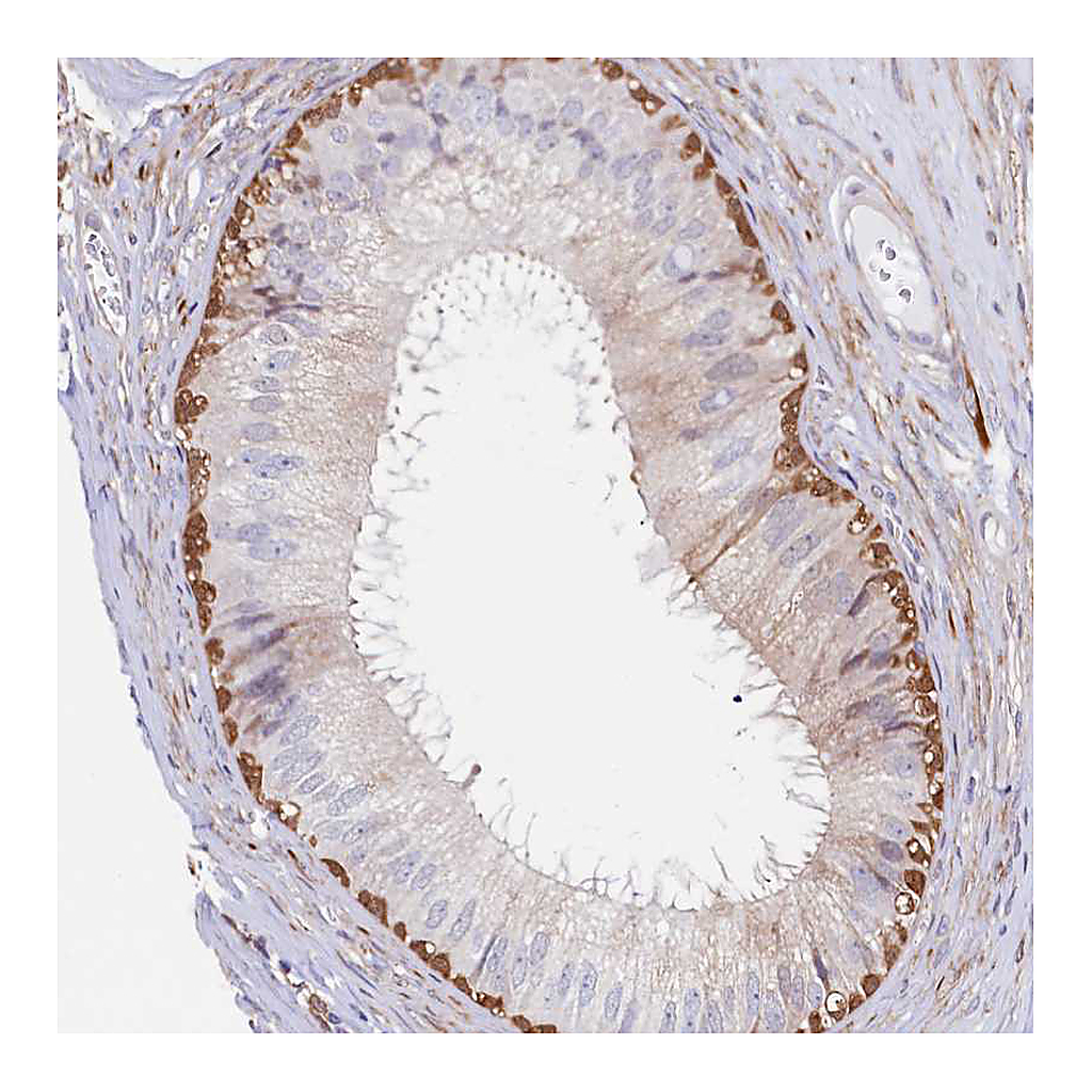 Atlas Antibodies Anti-ASTE1 Antibody