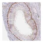 Atlas Antibodies Anti-ASTE1 Antibody