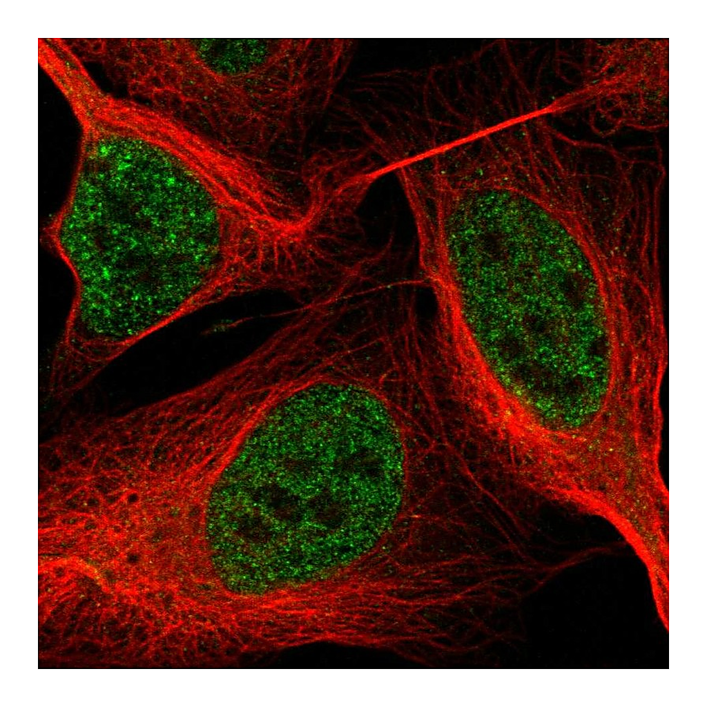 Atlas Antibodies Anti-ASXL2 Antibody